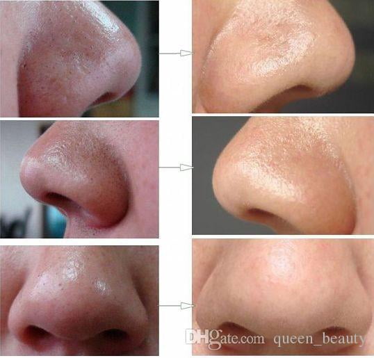 10-5000 Lot PILATEN blackhead remover mud black mask ance pore strip Wholesale 1000 PCS Re Vive - Moisturizing Renewal Serum Nightly Repair Booster - 30ml/1oz